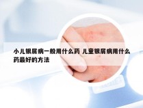 小儿银屑病一般用什么药 儿童银屑病用什么药最好的方法