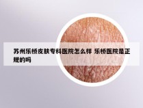 苏州乐桥皮肤专科医院怎么样 乐桥医院是正规的吗