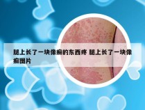 腿上长了一块像癣的东西疼 腿上长了一块像癣图片