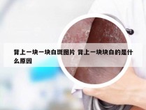 背上一块一块白斑图片 背上一块块白的是什么原因