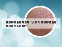 皮肤癣的治疗方法用什么药膏 皮肤癣的治疗方法用什么药膏好