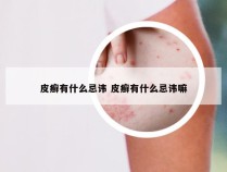 皮癣有什么忌讳 皮癣有什么忌讳嘛