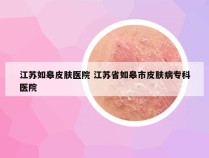 江苏如皋皮肤医院 江苏省如皋市皮肤病专科医院