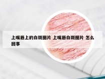 上嘴唇上的白斑图片 上嘴唇白斑图片 怎么回事