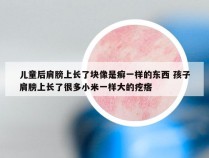 儿童后肩膀上长了块像是癣一样的东西 孩子肩膀上长了很多小米一样大的疙瘩