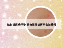 脓包银屑病怀孕 脓包银屑病怀孕会加重吗