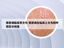 银屑病临床常分为 银屑病在临床上分为四种类型分别是