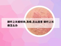 脚杆上长癣样块,发痒,怎么回事 脚杆上长癣怎么办