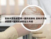 吉林大学白求恩第一医院皮肤科 吉林大学白求恩第一医院皮肤科在几号楼