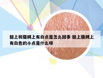 腿上和胳膊上有白点是怎么回事 腿上胳膊上有白色的小点是什么呀