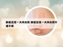 脚底出现一大块白斑 脚底出现一大块白斑不痛不痒