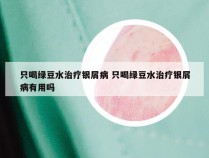 只喝绿豆水治疗银屑病 只喝绿豆水治疗银屑病有用吗