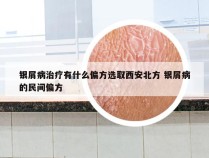 银屑病治疗有什么偏方选取西安北方 银屑病的民间偏方