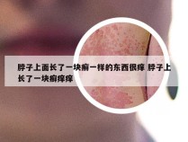 脖子上面长了一块癣一样的东西很痒 脖子上长了一块癣痒痒