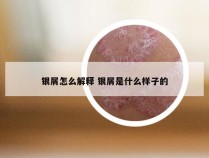 银屑怎么解释 银屑是什么样子的