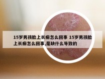 15岁男孩脸上长癣怎么回事 15岁男孩脸上长癣怎么回事,是缺什么导致的