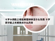 十岁小孩脸上老起癣是缺缺乏什么东西 十岁孩子脸上长癣抹点什么药膏