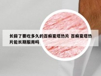 长藓了要吃多久的百癣夏塔热片 百癣夏塔热片能长期服用吗