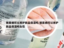 银屑病可以用护肤品保湿吗 银屑病可以用护肤品保湿吗女性