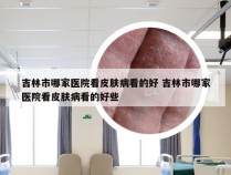 吉林市哪家医院看皮肤病看的好 吉林市哪家医院看皮肤病看的好些