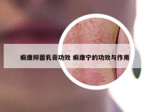 癣康抑菌乳膏功效 癣康宁的功效与作用