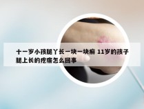 十一岁小孩腿丫长一块一块癣 11岁的孩子腿上长的疙瘩怎么回事