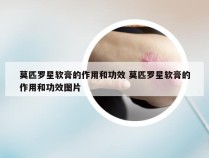 莫匹罗星软膏的作用和功效 莫匹罗星软膏的作用和功效图片