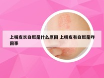 上嘴皮长白斑是什么原因 上嘴皮有白斑是咋回事