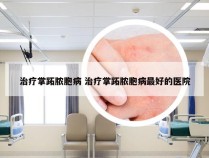 治疗掌跖脓胞病 治疗掌跖脓胞病最好的医院