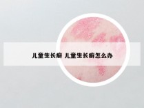 儿童生长癣 儿童生长癣怎么办