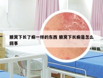 腋窝下长了癣一样的东西 腋窝下长癣是怎么回事