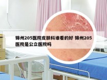 锦州205医院皮肤科谁看的好 锦州205医院是公立医院吗