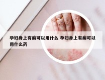 孕妇身上有癣可以用什么 孕妇身上有癣可以用什么药