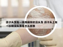 孩子头顶有一块像癣样的没头发 孩子头上有一小块没头发是怎么回事