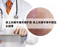 身上长癣不痛不痒扩散 身上长癣不疼不痒怎么回事