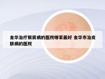 金华治疗银屑病的医院哪家最好 金华市治皮肤病的医院