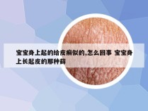 宝宝身上起的给皮癣似的,怎么回事 宝宝身上长起皮的那种藓