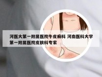 河医大第一附属医院牛皮癣科 河南医科大学第一附属医院皮肤科专家