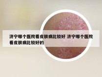 济宁哪个医院看皮肤病比较好 济宁哪个医院看皮肤病比较好的