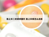 脸上长廯的症状图片 脸上长癍怎么去除