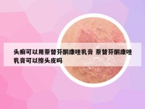 头癣可以用萘替芬酮康唑乳膏 萘替芬酮康唑乳膏可以擦头皮吗