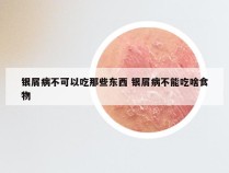 银屑病不可以吃那些东西 银屑病不能吃啥食物