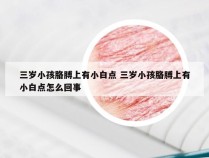 三岁小孩胳膊上有小白点 三岁小孩胳膊上有小白点怎么回事