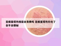 百癣夏塔热排尿会发黄吗 百癣夏塔热片吃了会不会便秘