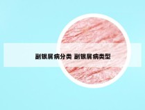 副银屑病分类 副银屑病类型