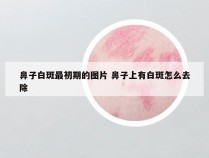 鼻子白斑最初期的图片 鼻子上有白斑怎么去除