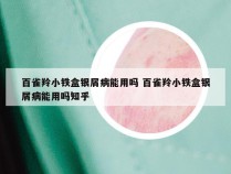 百雀羚小铁盒银屑病能用吗 百雀羚小铁盒银屑病能用吗知乎