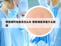 银屑病开始复发怎么办 银屑病复发是什么原因