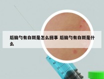 后脑勺有白斑是怎么回事 后脑勺有白斑是什么