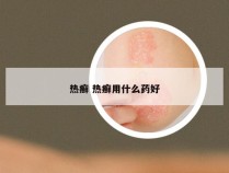 热癣 热癣用什么药好